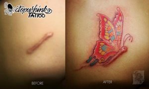 Lee más sobre el artículo Grandes Ideas para Ocultar las Cicatrices con Tatuajes